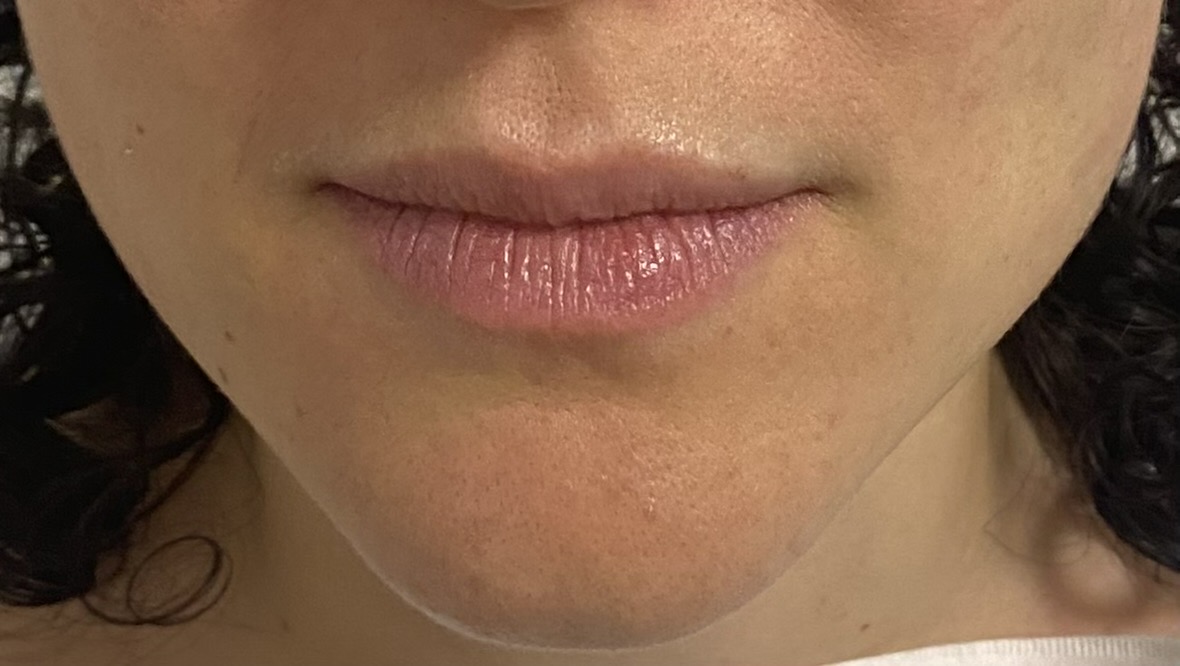 Caso de recuperación Después